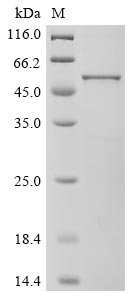 Bovine coronavirus Nucleoprotein (N) Recombinant Protein, C-His, aa 1–448, strain LY-138, Bovine coronavirus (strain LY-138) (BCoV) (BCV), E.coli, C-terminal 6xHis-tagged, 50.3 kDa, purity >≥ 85% as determined by SDS-PAGE.