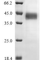 Mouse Protein Wnt-4 (Wnt4) Recombinant Protein, C-His, aa 23–351, Baculovirus - BioCrest Sci