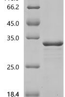 Candida albicans Hyphally-regulated protein (HYR1), partial Recombinant Protein, C-His - BioCrest Sci