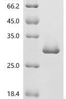 Mouse Cell division control protein 42 homolog (Cdc42) Recombinant Protein - BioCrest Sci