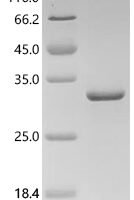 Pig Transferrin receptor protein 1 (TFRC), partial Recombinant Protein, C-His - BioCrest Sci