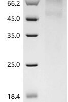 Mouse Protein RD3 (Rd3) Recombinant Protein - BioCrest Sci