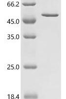 Human CCAAT/enhancer-binding protein beta (CEBPB) Recombinant Protein - BioCrest Sci