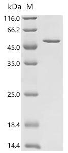Human CCAAT/enhancer-binding protein beta (CEBPB) Recombinant Protein, Homo sapiens (Human), E.coli, C-terminal 6xHis-tagged, 43.0 kDa, purity >≥ 90% as determined by SDS-PAGE.