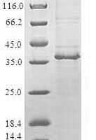 Human Peroxisomal carnitine O-octanoyltransferase (CROT) Recombinant Protein - BioCrest Sci