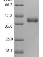 Human 28S ribosomal protein S16, mitochondrial (MRPS16) Recombinant Protein - BioCrest Sci