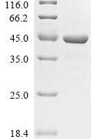 Penaeus aztecus Tropomyosin Pen a 1.0102 Recombinant Protein - BioCrest Sci
