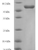Escherichia coli 3-oxoacyl-[acyl-carrier-protein] synthase 2 (fabF) Recombinant Protein - BioCrest Sci