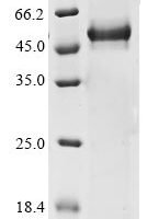 Human Lysyl oxidase homolog 3 (LOXL3), partial Recombinant Protein - BioCrest Sci