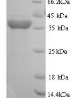 Rat Regucalcin (Rgn) Recombinant Protein, N-His - BioCrest Sci