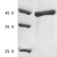 Rat 72 kDa type IV collagenase (Mmp2), partial Recombinant Protein - BioCrest Sci