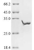 Human Acetylcholine receptor subunit epsilon (CHRNE), partial Recombinant Protein, N-10His/C-Myc - BioCrest Sci