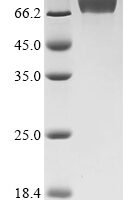 Mouse Carboxylesterase 1C (Ces1c), partial Recombinant Protein, N-10His/C-Myc - BioCrest Sci