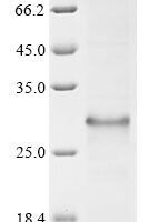 Blomia tropicalis Major allergen Blo t 12 Recombinant Protein - BioCrest Sci