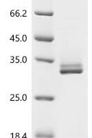 Mouse Insulin-like growth factor-binding protein 1 (Igfbp1) Recombinant Protein - BioCrest Sci