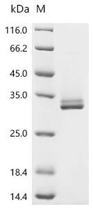 Mouse Insulin-like growth factor-binding protein 1 (Igfbp1) Recombinant Protein, Mus musculus (Mouse), Mammalian cell, C-terminal 10xHis-tagged, 28.3 kDa, purity >≥ 95% as determined by SDS-PAGE.