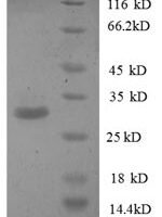 Human Phosphatidylserine synthase 1 (PTDSS1), partial Recombinant Protein - BioCrest Sci