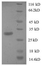 Human Phosphatidylserine synthase 1 (PTDSS1), partial Recombinant Protein, Homo sapiens (Human), E.coli, N-terminal GST-tagged, 31.1 kDa, purity >≥ 90% as determined by SDS-PAGE.