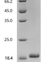 Human Caspase-8 (CASP8), partial Recombinant Protein, N-His, aa 217–374, Yeast - BioCrest Sci