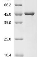 Human Folliculin (FLCN) Recombinant Protein - BioCrest Sci