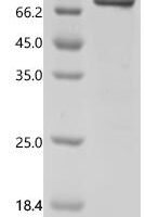 Human Acylamino-acid-releasing enzyme (APEH) Recombinant Protein - BioCrest Sci