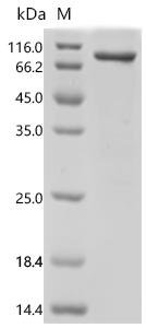 Human Acylamino-acid-releasing enzyme (APEH) Recombinant Protein, Homo sapiens (Human), E.coli, C-terminal 6xHis-tagged, 88.2 kDa, purity >≥ 85% as determined by SDS-PAGE.