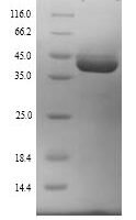 Mouse Ubiquitin-protein ligase E3A (Ube3a), partial Recombinant Protein, N-His, aa 542–870, Yeast - BioCrest Sci