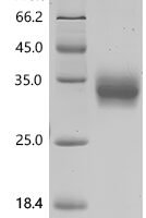 Mouse T-cell surface glycoprotein CD8 alpha chain (Cd8a), partial, Biotinylated Recombinant Protein - BioCrest Sci