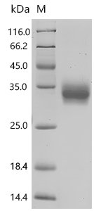 Mouse T-cell surface glycoprotein CD8 alpha chain (Cd8a), partial, Biotinylated Recombinant Protein, Mus musculus (Mouse), Mammalian cell, C-terminal 10xHis-Avi-tagged, 22.4 kDa, purity >≥ 95% as determined by SDS-PAGE.