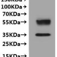 Human C-X-C chemokine receptor type 6 (CXCR6)-VLPs Recombinant Protein - BioCrest Sci