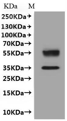 Human C-X-C chemokine receptor type 6 (CXCR6)-VLPs Recombinant Protein, Homo sapiens (Human), Mammalian cell, C-terminal 10xHis-tagged(This tag can be tested only under denaturing conditions), 40.8 kDa, purity >≥ 90% as determined by SEC-HPLC.