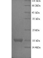 Rat RegeneRating islet-derived protein 3-gamma (Reg3g) Recombinant Protein - BioCrest Sci