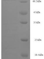 Human DDB1- and CUL4-associated factor 4 (DCAF4) Recombinant Protein - BioCrest Sci