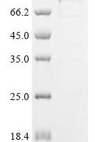 Human Cholesterol side-chain cleavage enzyme, mitochondrial (CYP11A1),Biotinylated Recombinant Protein - BioCrest Sci