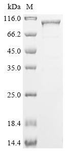 Human Cholesterol side-chain cleavage enzyme, mitochondrial (CYP11A1),Biotinylated Recombinant Protein, Homo sapiens (Human), E.coli, N-terminal MBP-tagged and C-terminal 6xHis-Avi-tagged, 103.9 kDa, purity >≥ 85% as determined by SDS-PAGE.