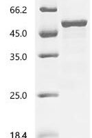 Human Dihydroorotate dehydrogenase (quinone), mitochondrial (DHODH), partial Recombinant Protein, C-10His - BioCrest Sci