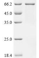 Human Leucine-rich repeat LGI family member 2 (LGI2) Recombinant Protein - BioCrest Sci