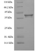 Human ER membrane protein complex subunit 9 (EMC9) Recombinant Protein - BioCrest Sci