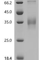 Human GTPase NRas (NRAS) Recombinant Protein, C-His-Myc - BioCrest Sci