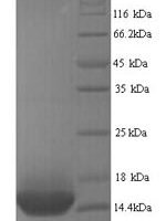 Human Beta-1 adrenergic receptor (ADRB1), partial Recombinant Protein - BioCrest Sci