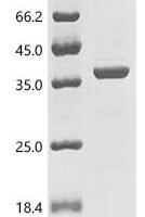Pseudomonas aeruginosa Lipase LipC (lipC) Recombinant Protein - BioCrest Sci