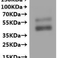 Human Beta-1 adrenergic receptor(ADRB1)-VLPs Recombinant Protein - BioCrest Sci