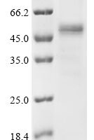Human Meiotic recombination protein SPO11 (SPO11) Recombinant Protein, C-His, aa 1–396, Baculovirus - BioCrest Sci
