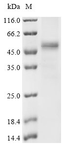 Human Meiotic recombination protein SPO11 (SPO11) Recombinant Protein, C-His, aa 1–396, Baculovirus, Homo sapiens (Human), Baculovirus, C-terminal 6xHis-tagged, 47.3 kDa, purity >≥ 85% as determined by SDS-PAGE.
