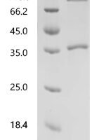 Human Neurogenic locus notch homolog protein 1 (NOTCH1), partial Recombinant Protein, N-hFc1 - BioCrest Sci