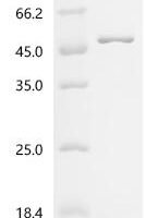 Rice tungro bacilliform virus Polyprotein, partial (I669V) Recombinant Protein - BioCrest Sci