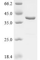 Human Atrial natriuretic peptide receptor 3 (NPR3), partial Recombinant Protein, N-His-GST - BioCrest Sci