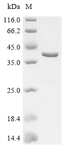 Human Atrial natriuretic peptide receptor 3 (NPR3), partial Recombinant Protein, N-His-GST, Homo sapiens (Human), E.coli, N-terminal 6xHis-GST-tagged, 41.5 kDa, purity >≥ 85% as determined by SDS-PAGE.
