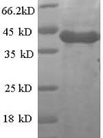 Human Casein kinase I isoform alpha (CSNK1A1) Recombinant Protein - BioCrest Sci