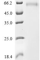 Horse Plasminogen activator inhibitor-1 (PAI-1), partial Recombinant Protein - BioCrest Sci